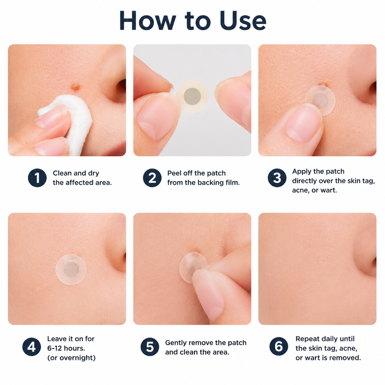 🔥Elmstr®2-in-1 Microneedle & Hydrocolloid Patch🍀| Removes Raised Moles, Acne, Flat Warts & Skin Tags | Helps Improve Wrinkles, Scars & Blemishes | Invisible Patches for Face & Body