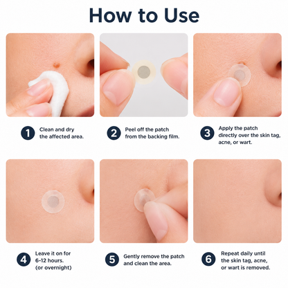🔥Elmstr®2-in-1 Microneedle & Hydrocolloid Patch🍀| Removes Raised Moles, Acne, Flat Warts & Skin Tags | Helps Improve Wrinkles, Scars & Blemishes | Invisible Patches for Face & Body