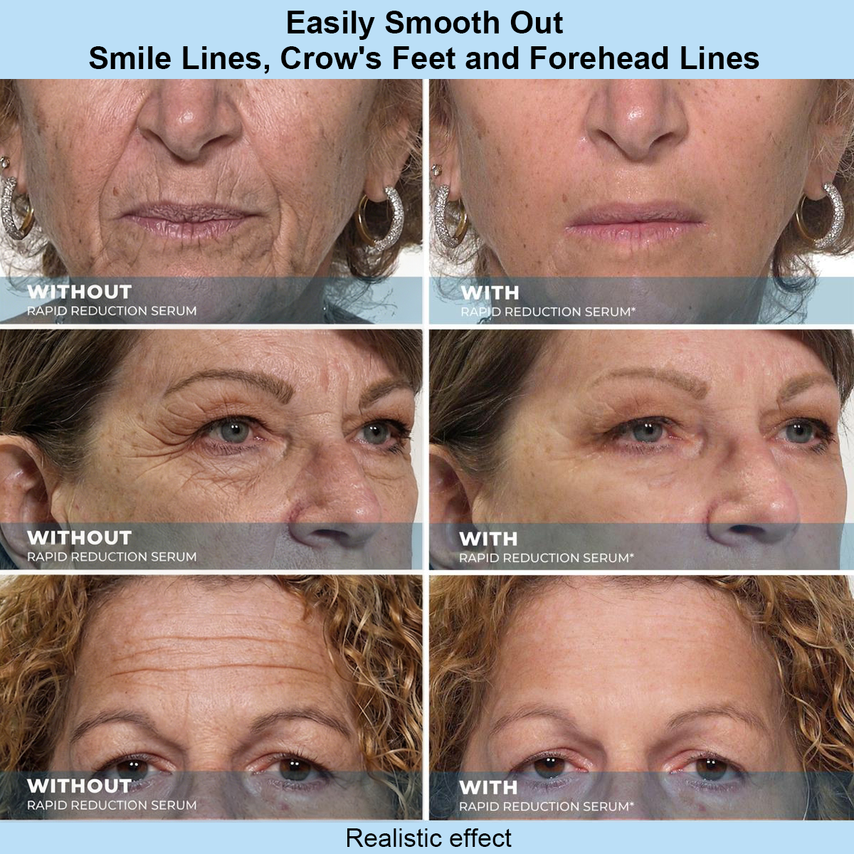 Elmstr™ Instant Face Temporary Tightener – Instant visible results in 30 seconds