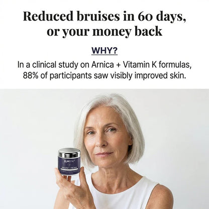 💥100K+ SOLD💕- Elmstr® Bruise Repair & Skin-Strengthening Cream