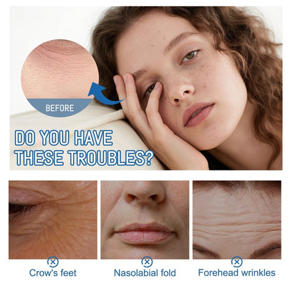 Elmstr™ Instant Face Temporary Tightener – Instant visible results in 30 seconds