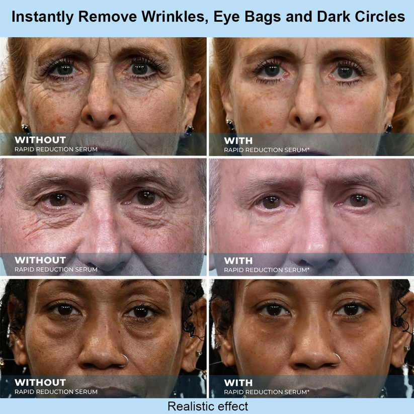 Elmstr™ Instant Face Temporary Tightener – Instant visible results in 30 seconds