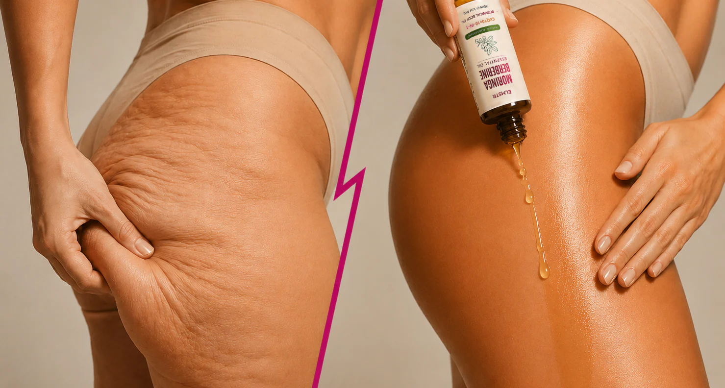 Body contouring and skin elasticity